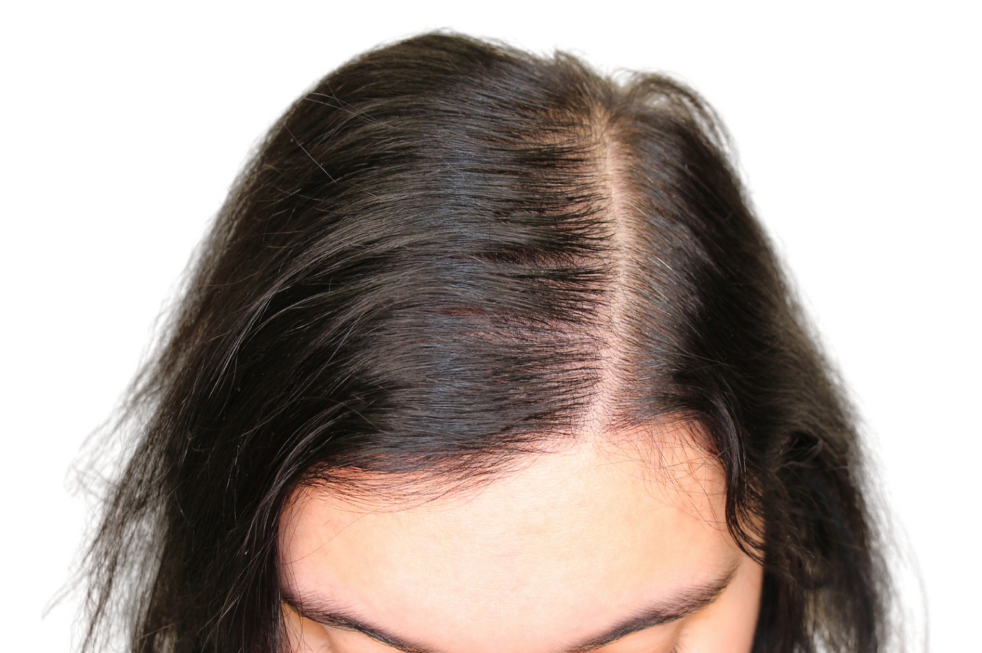 Instant-Hair-Female-Before